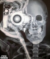 Pfostenbild